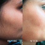 3 x Facial Hair Serum