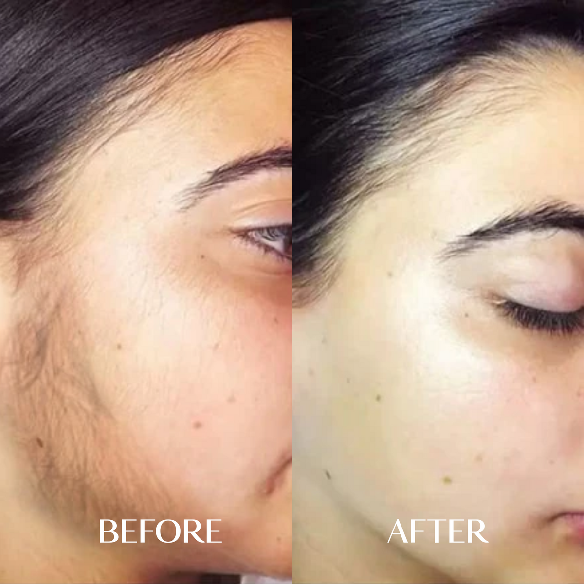 6 x Facial Hair Serum