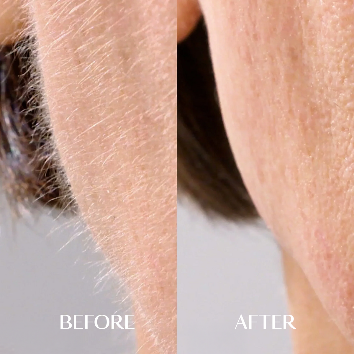 6 x Facial Hair Serum