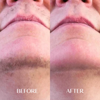 1 x Facial Hair Serum