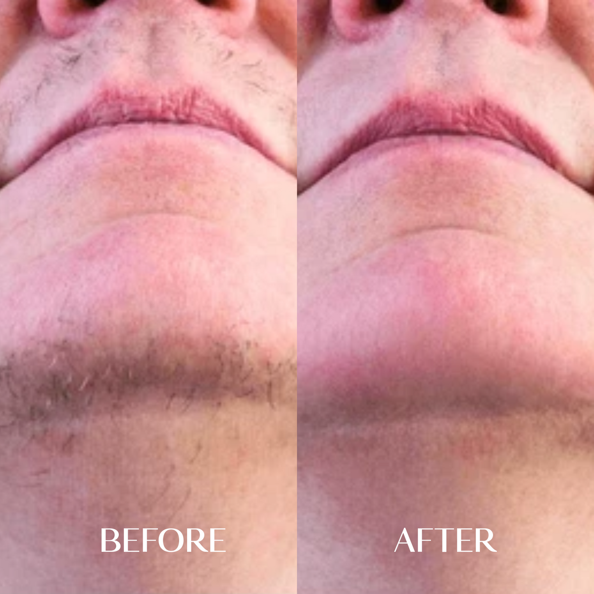 1 x Facial Hair Serum