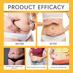 Anti Cellulite Fat Burner Weight Loss Cream