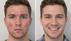 Rosacea Corrector (Men’s Formula) | 1+1 FREE