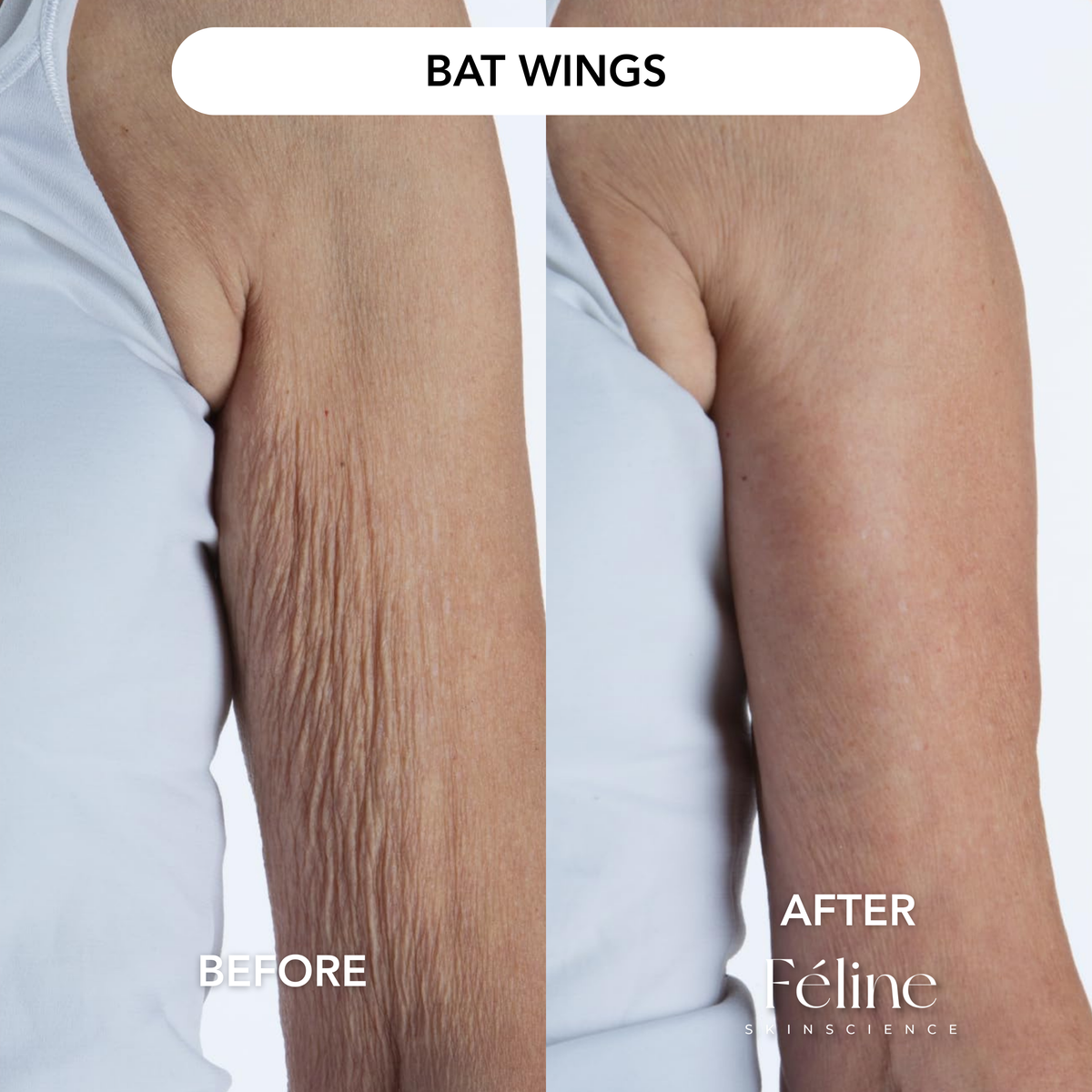 Loose Belly Skin Tightening Cream | 1+1 FREE