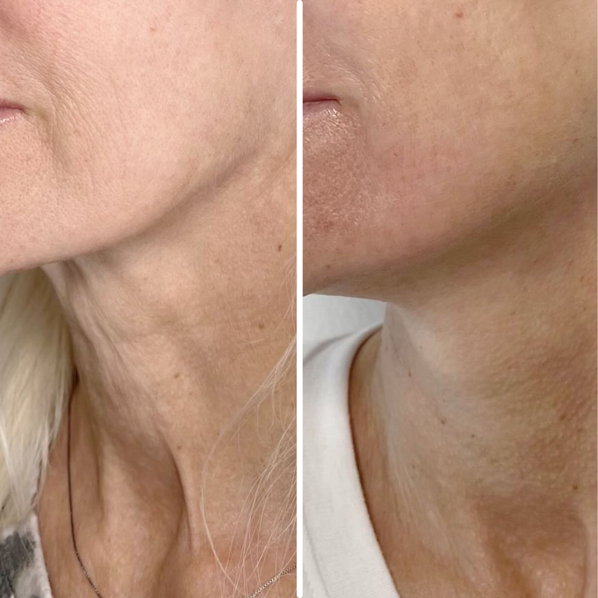 Age-Defying Neck Lift & Firm Cream | 1+1 FREE
