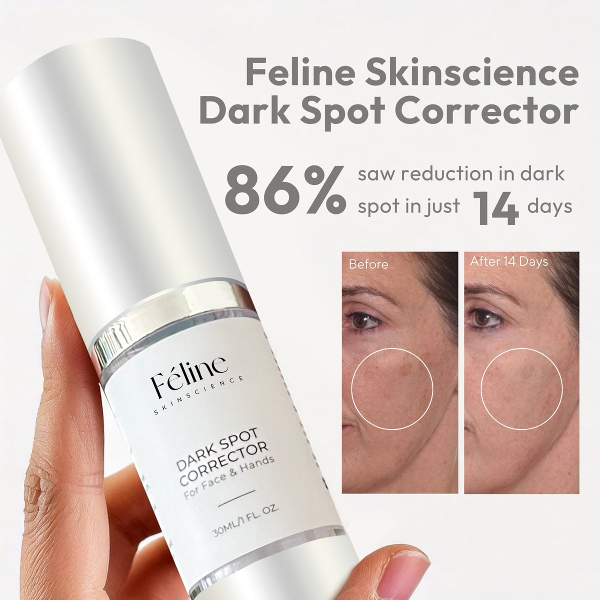 The Complete Dark Spot Solution | Erase & Block