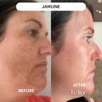 Face Serum for Brown Patches & Uneven Skin Tone | 1+1 FREE