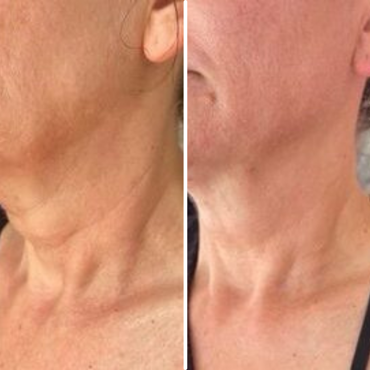 Age-Defying Neck Lift & Firm Cream | 1+1 FREE