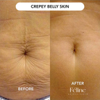 Loose Belly Skin Tightening Cream | 1+1 FREE