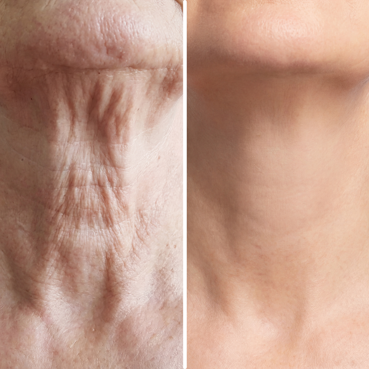 Age-Defying Neck Lift & Firm Cream | 1+1 FREE