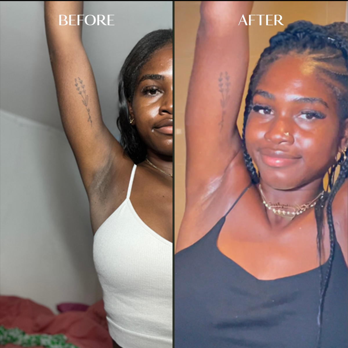 Body Brightening Corrector | 1+1 FREE