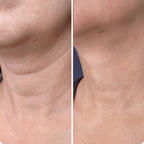 Age-Defying Neck Lift & Firm Cream | 1+1 FREE