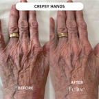 Turkey Neck Tightening Cream | 1+1 FREE