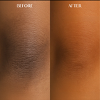 Body Brightening Corrector | 1+1 FREE