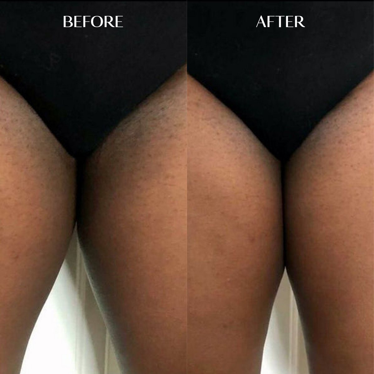 Body Brightening Corrector | 1+1 FREE