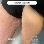 CrepeFree Arm™ | 1+1 FREE
