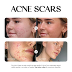 Dark Spot Corrector | 1+1 FREE