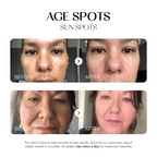Dark Spot Corrector | 1+1 FREE