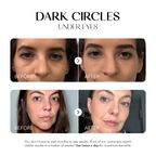 Dark Spot Corrector | 1+1 FREE