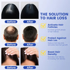 Hair Serum for Thinning Hair & Scalp Health
