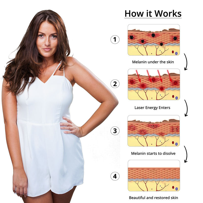 Picosecond Laser Tattoo Removal Pen for Tattoo Fading
