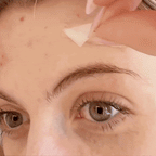 Hydrocolloid Acne Patches Roll for Pimples & Breakouts