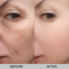 Peel Shot Rice Ampoule Duo For Skin Brightening & Hydration