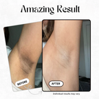 Peel Shot - Kojic + Turmeric Body Peel Spray