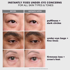 Instant Eye Tightening Cream for Wrinkles & Fine Lines