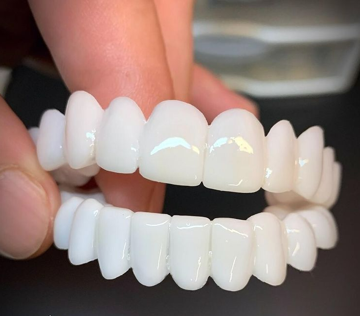 Removable Teeth Veneers | Fix Missing Teeth Instantly