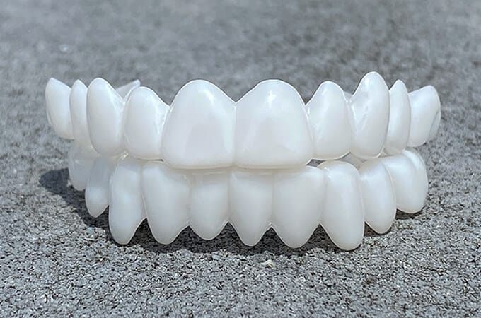 Removable Teeth Veneers | Fix Missing Teeth Instantly