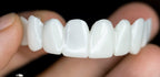 Snap-On Veneers for Missing Teeth | Instant Smile Fix