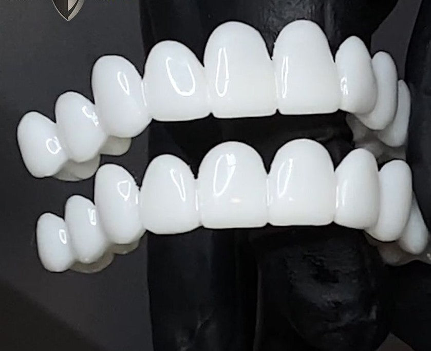 Removable Teeth Veneers | Fix Missing Teeth Instantly
