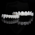 Instant Teeth Replacement Without Dentist | Snap-On Veneers