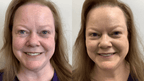 3 x Rosacea Corrector