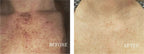 Dark Spot Corrector for Sun Spots & Age Spots | 1+1 FREE
