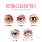 Eye Bag Removal Stick for Puffiness, Wrinkles & Dark Circles
