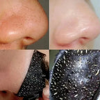 Charcoal Blackhead Mask for Deep Pore Cleansing & Acne