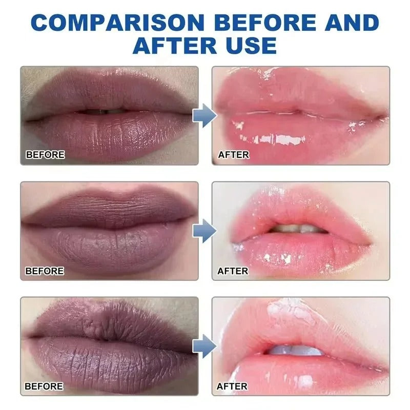 Dark Lip Lightening Balm – Pink Lip Exfoliator & Moisturizer for Dead Skin, Lip Line Fading & Hydration