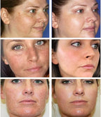 Dark Spot Corrector Serum for Hyperpigmentation & Melasma