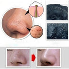 Charcoal Blackhead Mask for Deep Pore Cleansing & Acne