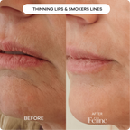Chest & Décolletage Wrinkle Cream | 1+1 FREE