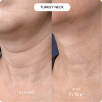 Wrinkled Hands Repair Cream | 1+1 FREE