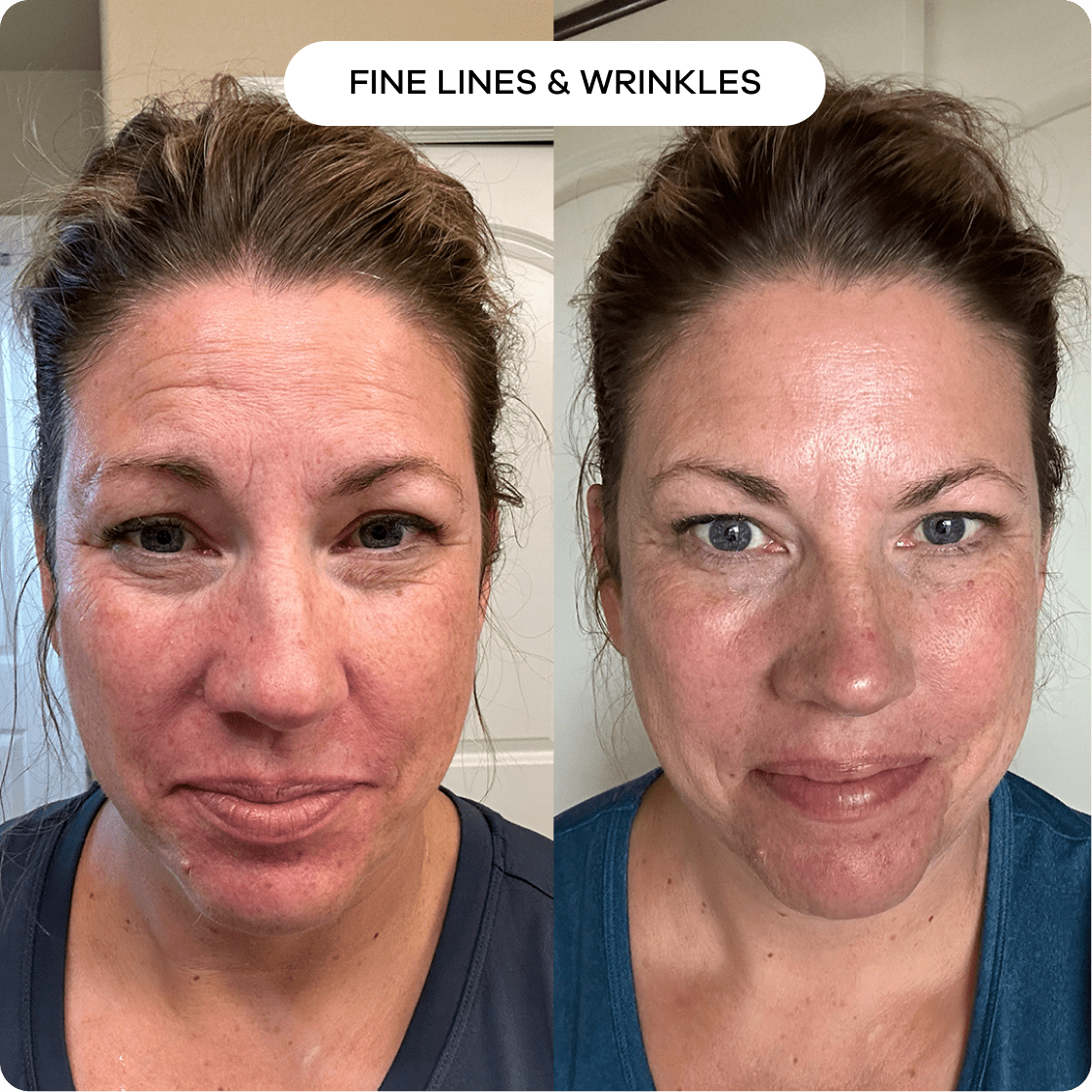 Turkey Neck Tightening Cream | 1+1 FREE